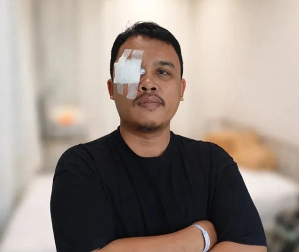 Foto unggahan instagram Palti Hutabarat