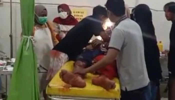 Korban saat dilarikan ke Puskesmas