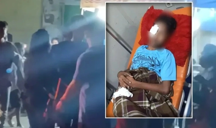 Remaja Gowa Jadi Korban Tembakan Peluru Jelly, Mata Kanan Terluka Parah Saat Nongkrong Usai Tarawih