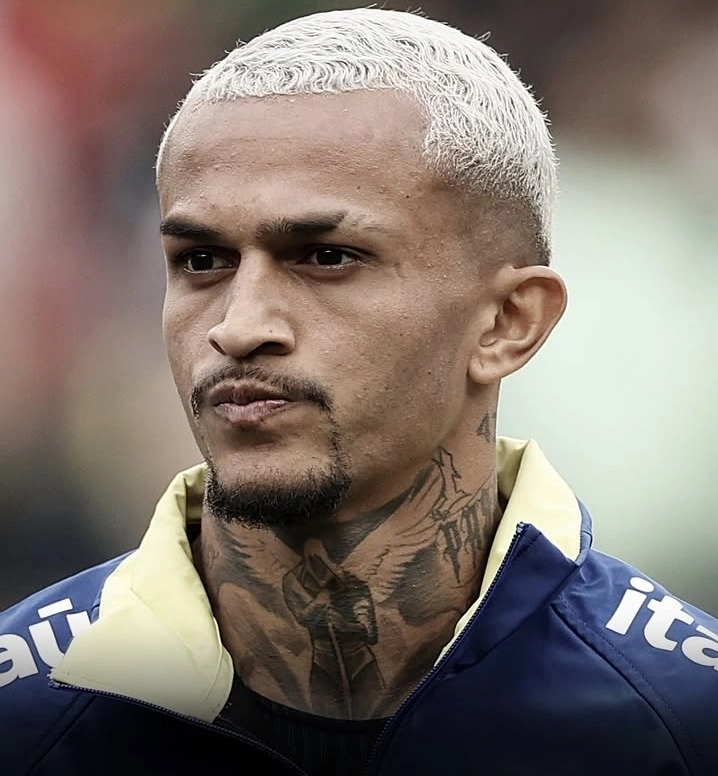 Wesley França Cedera, Brasil Kehilangan Bek Kanan Utama untuk Piala Dunia 2026
