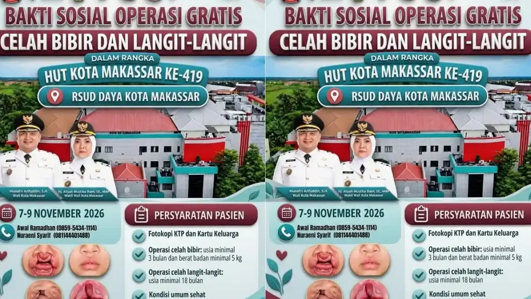 RSUD Daya Makassar membuka operasi celah bibir dan langit-langit gratis pada 7–9 November 2026.